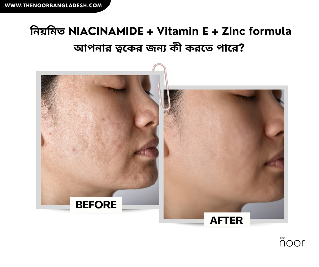 নিয়মিত NIACINAMIDE + Vitamin E formula আপনার ত্বকের জন্য কী করতে পারে?