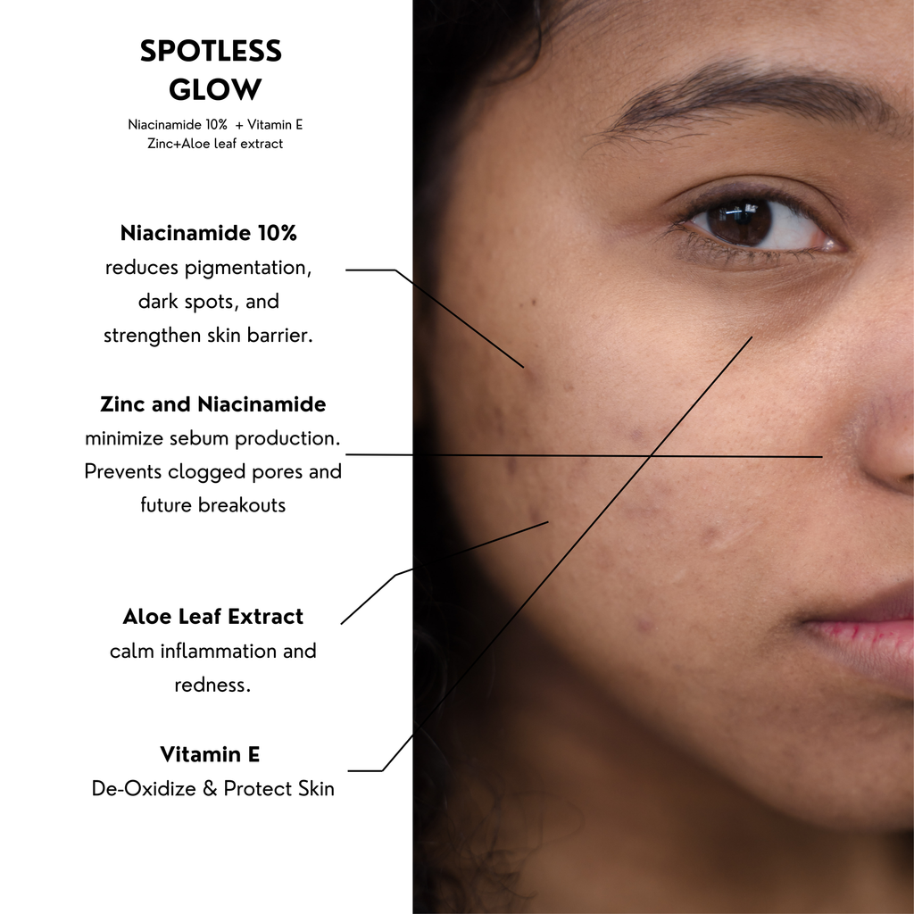 Spotless Glow | Niacinamide 10% + Vitamin E+  Zinc + Aloe leaf extract   | 30ml