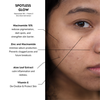 Spotless Glow | Niacinamide 10% + Vitamin E+  Zinc + Aloe leaf extract   | 30ml