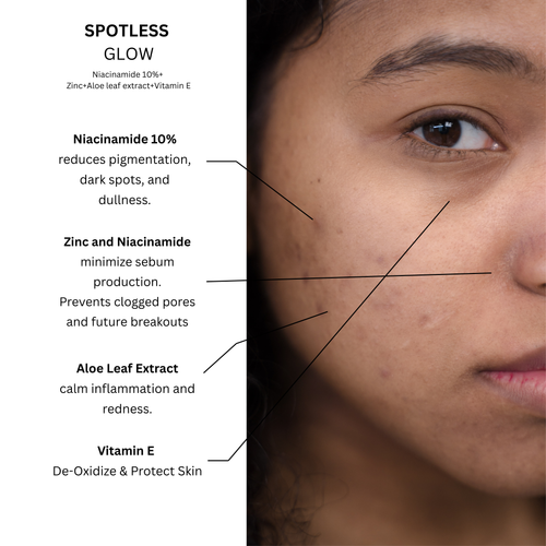 Spotless Glow | Niacinamide 10% + Vitamin E+  Zinc + Aloe leaf extract   | 30ml